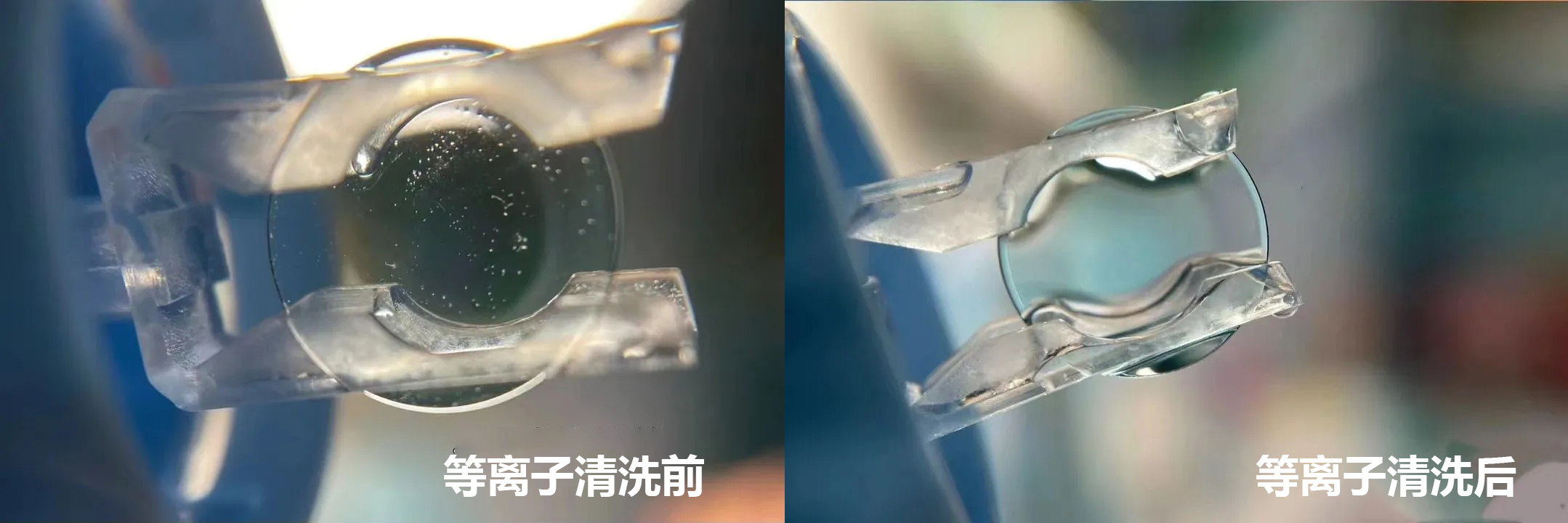 角膜塑形鏡（OK鏡）等離子清洗技術的應用